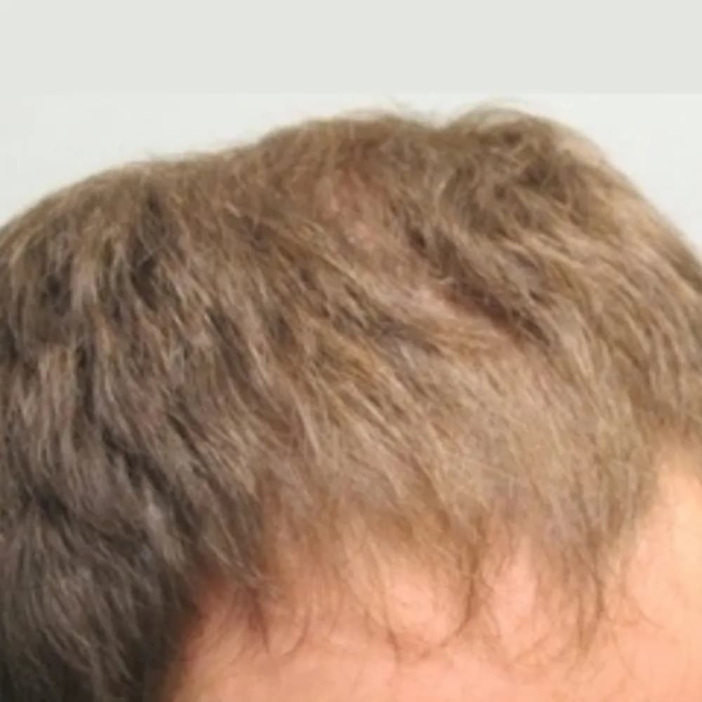 After
